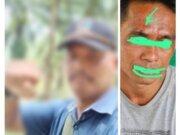 Sadis..!!! Arogansi oknum Papam Kebun Gunung monako Berinisial Am, Diduga Aniaya Warga secara Brutal, Hingga Berahir Beberapa Jaitan Di Bagian Pelipis Mata Korban