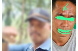 Sadis..!!! Arogansi oknum Papam Kebun Gunung monako Berinisial Am, Diduga Aniaya Warga secara Brutal, Hingga Berahir Beberapa Jaitan Di Bagian Pelipis Mata Korban