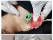 Beredar kabar, Seorang Terduga Pelaku Penembakan Pelajar di Sergai Ditangkap Polres Sergai